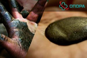 Чарас: что это за наркотик, чем он опасен и как лечить зависимость